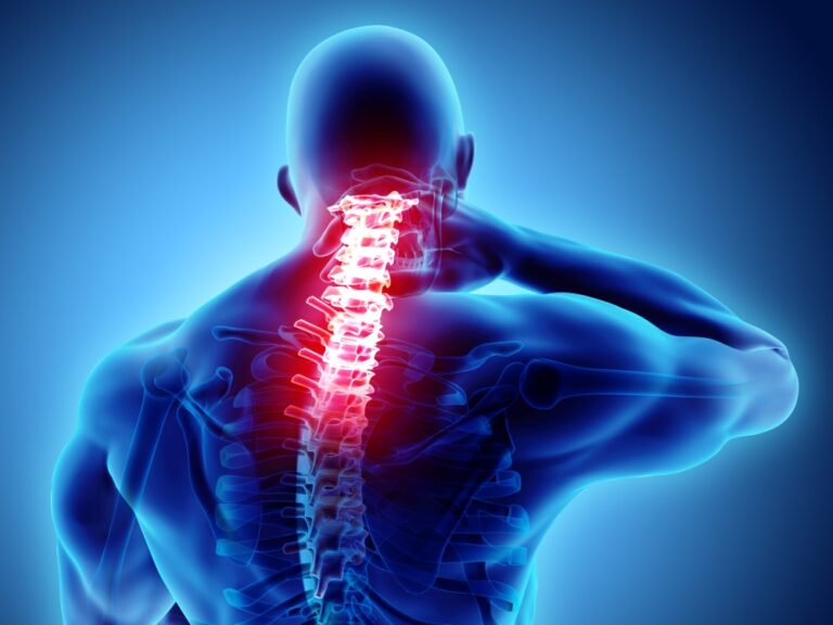 Classification and Treatment of Neck Pain | Panther Sports Medicine